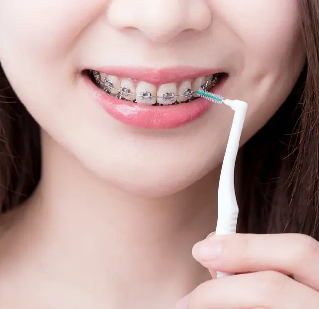 Interdental Brushes ສ້າງປະສົບການໃຫມ່ຂອງການດູແລຊ່ອງປາກທີ່ຫລອມໂລຫະ